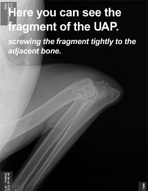 Canine Hip Dysplasia - Degenerative Joint Disease (Arthritis)