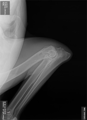 Canine Hip Dysplasia - Degenerative Joint Disease (Arthritis)