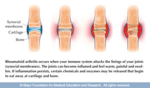 canine-arthritis